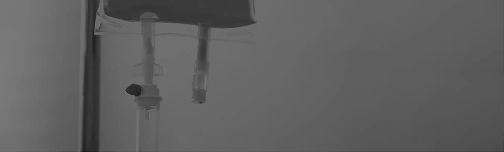 Acasa da Plastica